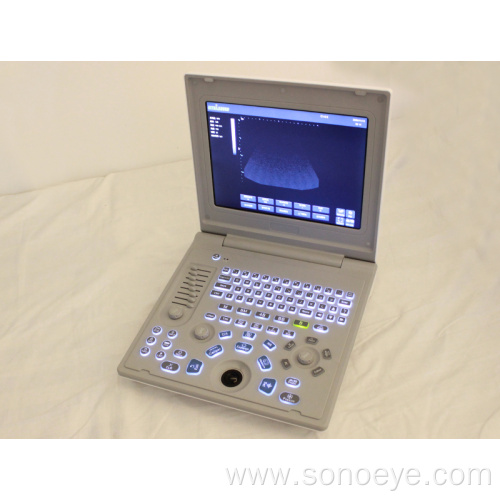 Laptop ultrasound machine with good quality